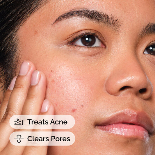 Salicylic Acid 2% Solution